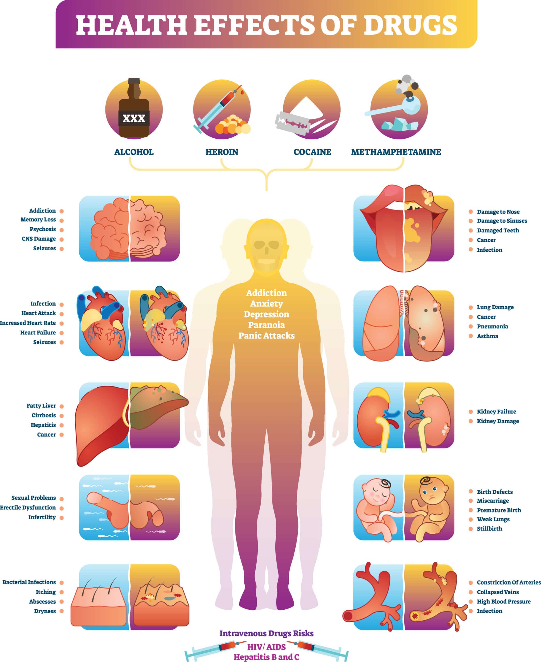 long-term health effects of drugs and alcohol